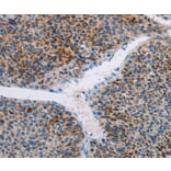 Immunohistochemistry - AMOTL2 Antibody from Signalway Antibody (36101) - Antibodies.com