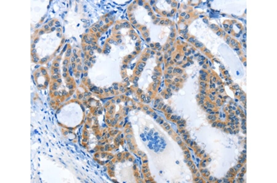 Immunohistochemistry - ANKMY1 Antibody from Signalway Antibody (36105) - Antibodies.com