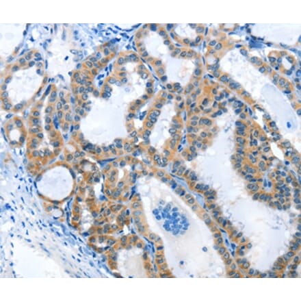 Immunohistochemistry - ANKMY1 Antibody from Signalway Antibody (36105) - Antibodies.com