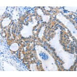 Immunohistochemistry - ANKMY1 Antibody from Signalway Antibody (36105) - Antibodies.com