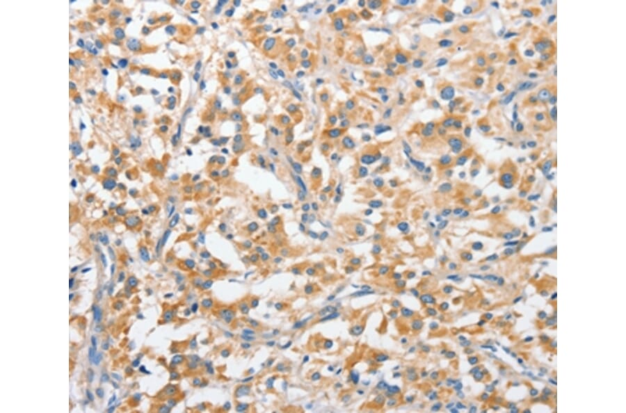 Immunohistochemistry - ANKMY2 Antibody from Signalway Antibody (36106) - Antibodies.com