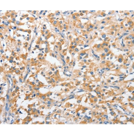 Immunohistochemistry - ANKMY2 Antibody from Signalway Antibody (36106) - Antibodies.com