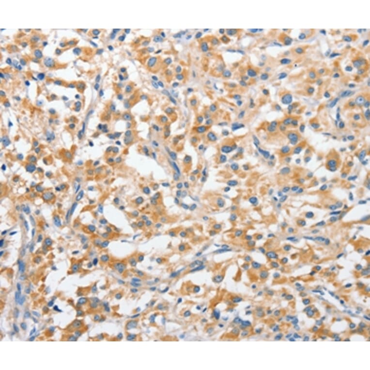 Immunohistochemistry - ANKMY2 Antibody from Signalway Antibody (36106) - Antibodies.com