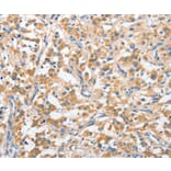 Immunohistochemistry - ANKMY2 Antibody from Signalway Antibody (36106) - Antibodies.com