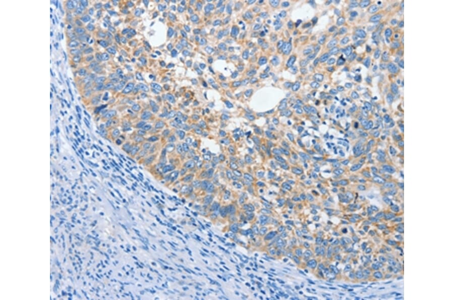 Immunohistochemistry - ANKMY2 Antibody from Signalway Antibody (36106) - Antibodies.com