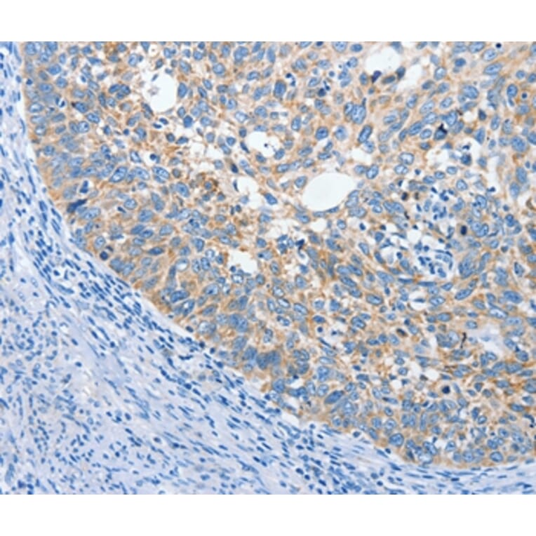 Immunohistochemistry - ANKMY2 Antibody from Signalway Antibody (36106) - Antibodies.com