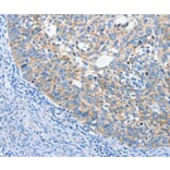 Immunohistochemistry - ANKMY2 Antibody from Signalway Antibody (36106) - Antibodies.com