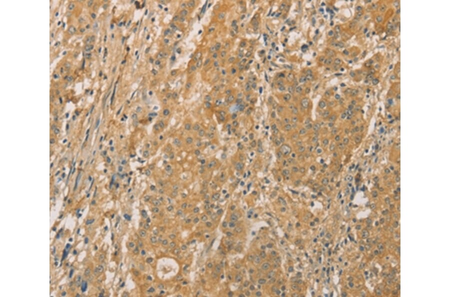 Immunohistochemistry - SNAP91 Antibody from Signalway Antibody (36109) - Antibodies.com