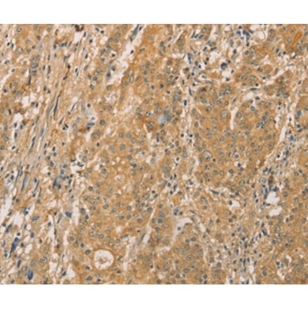 Immunohistochemistry - SNAP91 Antibody from Signalway Antibody (36109) - Antibodies.com