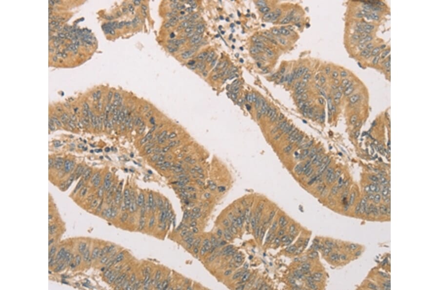 Immunohistochemistry - SNAP91 Antibody from Signalway Antibody (36109) - Antibodies.com