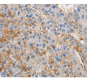 Immunohistochemistry - DIRAS3 Antibody from Signalway Antibody (36135) - Antibodies.com
