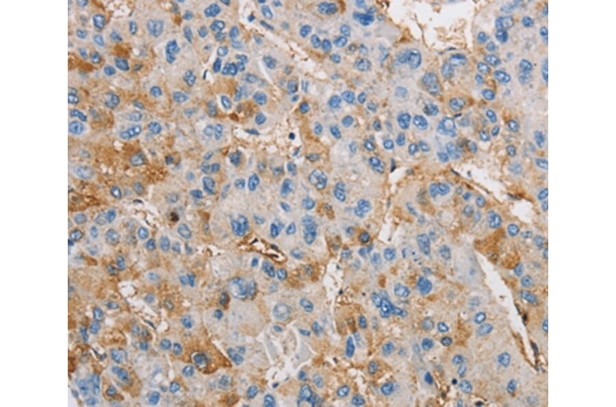 Immunohistochemistry - DIRAS3 Antibody from Signalway Antibody (36135) - Antibodies.com