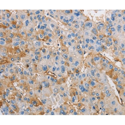 Immunohistochemistry - DIRAS3 Antibody from Signalway Antibody (36135) - Antibodies.com