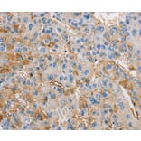 Immunohistochemistry - DIRAS3 Antibody from Signalway Antibody (36135) - Antibodies.com