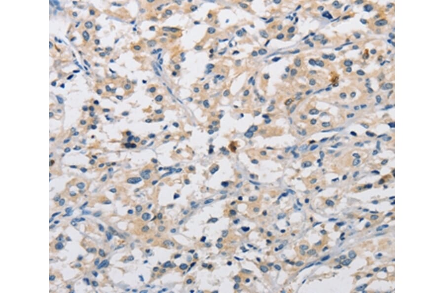 Immunohistochemistry - DIRAS3 Antibody from Signalway Antibody (36135) - Antibodies.com