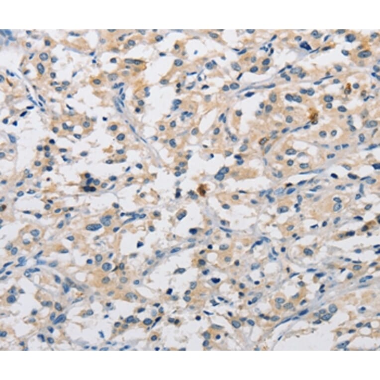 Immunohistochemistry - DIRAS3 Antibody from Signalway Antibody (36135) - Antibodies.com