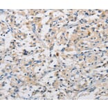 Immunohistochemistry - DIRAS3 Antibody from Signalway Antibody (36135) - Antibodies.com