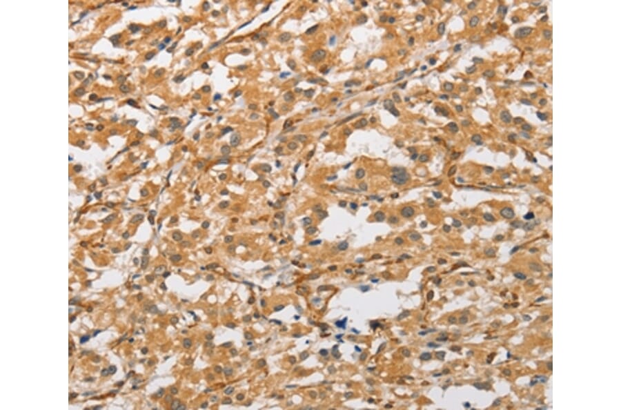 Immunohistochemistry - ARMCX1 Antibody from Signalway Antibody (36139) - Antibodies.com
