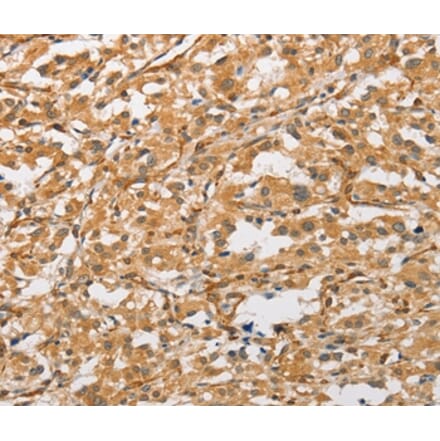 Immunohistochemistry - ARMCX1 Antibody from Signalway Antibody (36139) - Antibodies.com