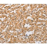 Immunohistochemistry - ARMCX1 Antibody from Signalway Antibody (36139) - Antibodies.com