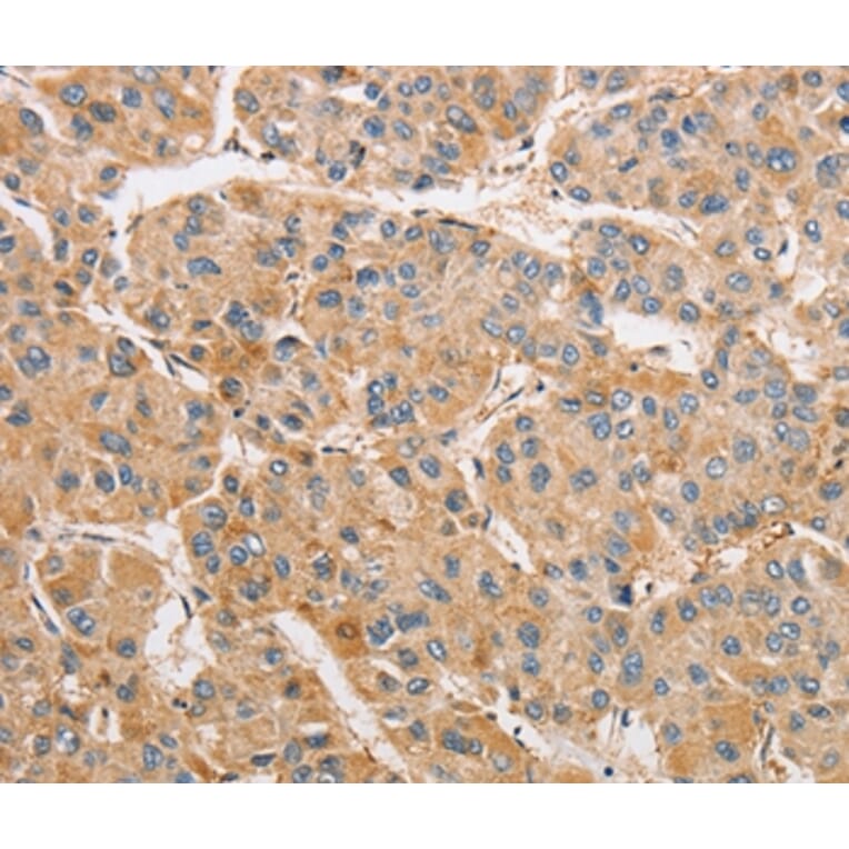 Immunohistochemistry - ARMCX1 Antibody from Signalway Antibody (36139) - Antibodies.com