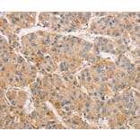 Immunohistochemistry - ARMCX1 Antibody from Signalway Antibody (36139) - Antibodies.com