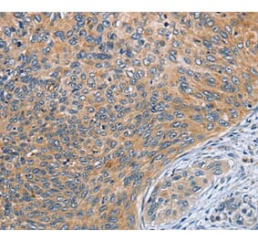 Immunohistochemistry - SPIRE2 Antibody from Signalway Antibody (36144) - Antibodies.com