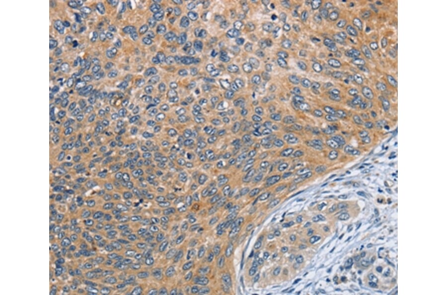 Immunohistochemistry - SPIRE2 Antibody from Signalway Antibody (36144) - Antibodies.com