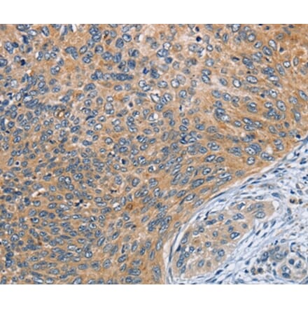 Immunohistochemistry - SPIRE2 Antibody from Signalway Antibody (36144) - Antibodies.com