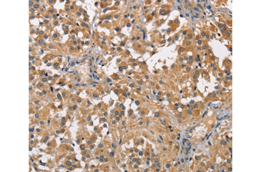 Immunohistochemistry - SPIRE2 Antibody from Signalway Antibody (36144) - Antibodies.com