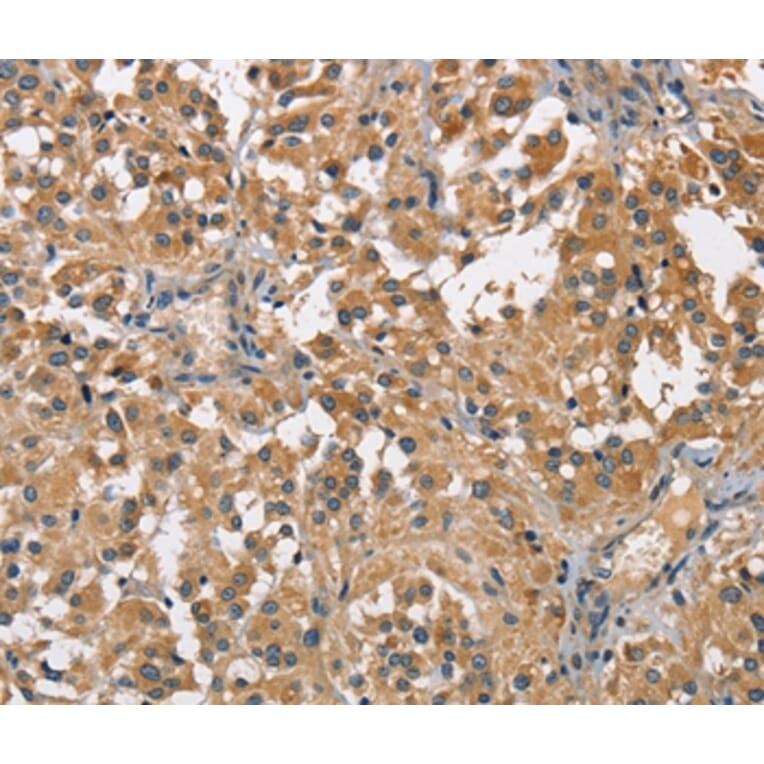 Immunohistochemistry - SPIRE2 Antibody from Signalway Antibody (36144) - Antibodies.com