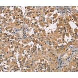 Immunohistochemistry - SPIRE2 Antibody from Signalway Antibody (36144) - Antibodies.com