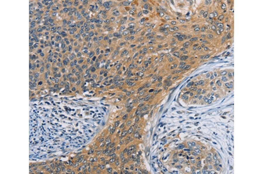 Immunohistochemistry - ORMDL3 Antibody from Signalway Antibody (36145) - Antibodies.com