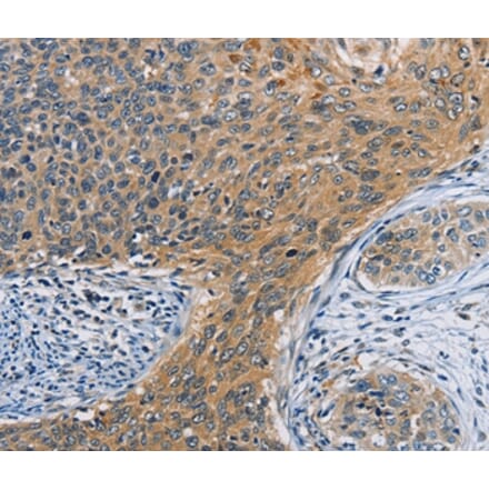 Immunohistochemistry - ORMDL3 Antibody from Signalway Antibody (36145) - Antibodies.com
