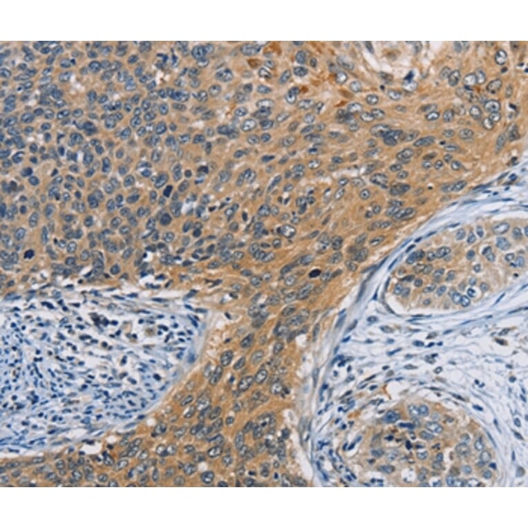 Immunohistochemistry - ORMDL3 Antibody from Signalway Antibody (36145) - Antibodies.com