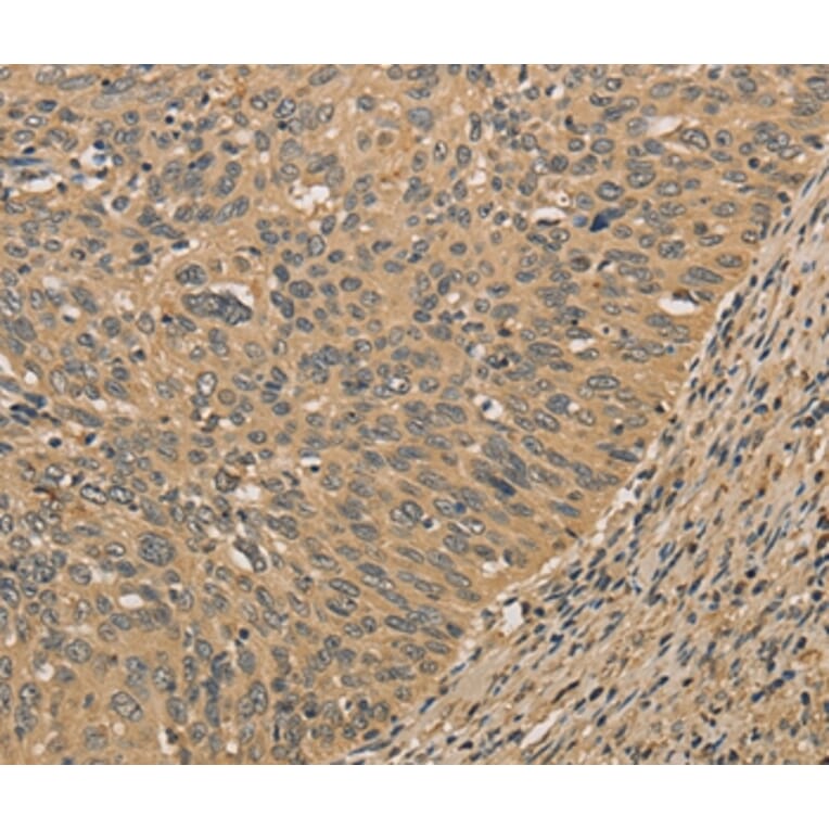 Immunohistochemistry - PRDM14 Antibody from Signalway Antibody (36151) - Antibodies.com