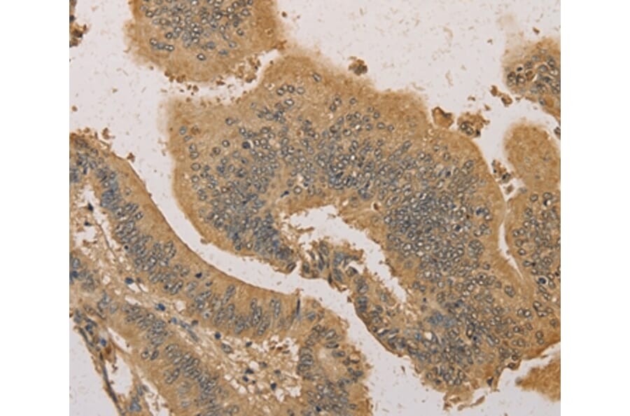 Immunohistochemistry - PRDM14 Antibody from Signalway Antibody (36151) - Antibodies.com