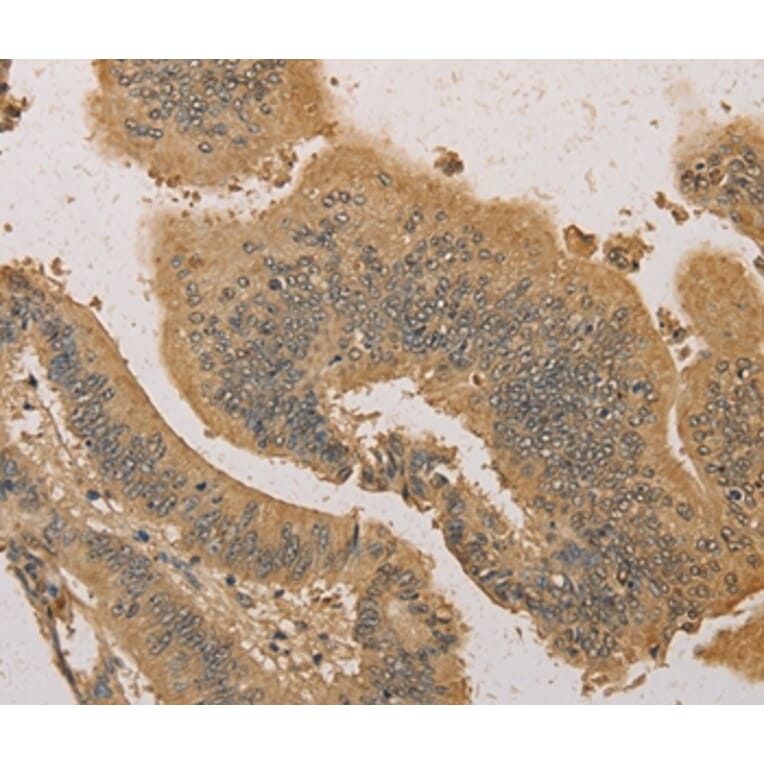 Immunohistochemistry - PRDM14 Antibody from Signalway Antibody (36151) - Antibodies.com
