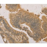 Immunohistochemistry - PRDM14 Antibody from Signalway Antibody (36151) - Antibodies.com