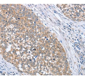 Immunohistochemistry - PAPSS1 Antibody from Signalway Antibody (36177) - Antibodies.com