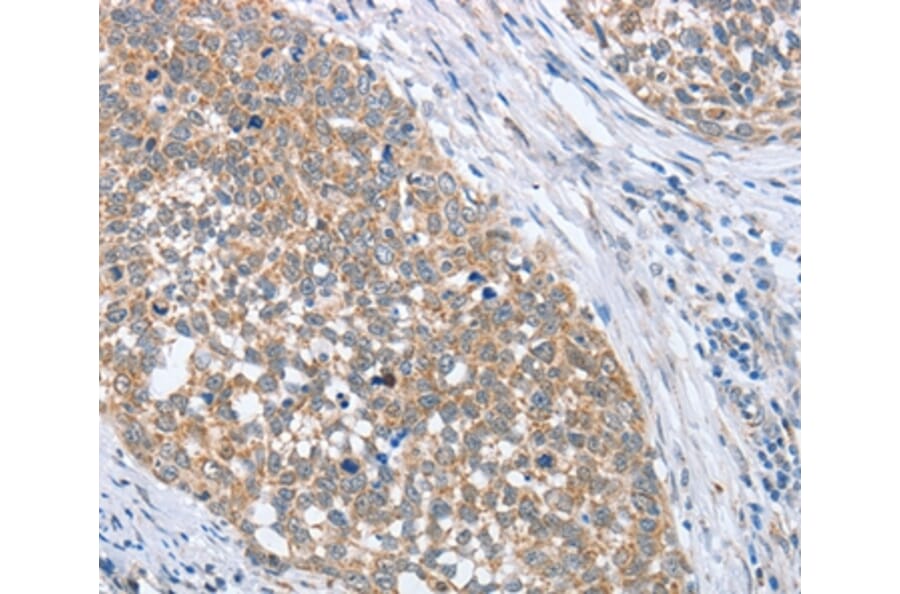 Immunohistochemistry - PAPSS1 Antibody from Signalway Antibody (36177) - Antibodies.com