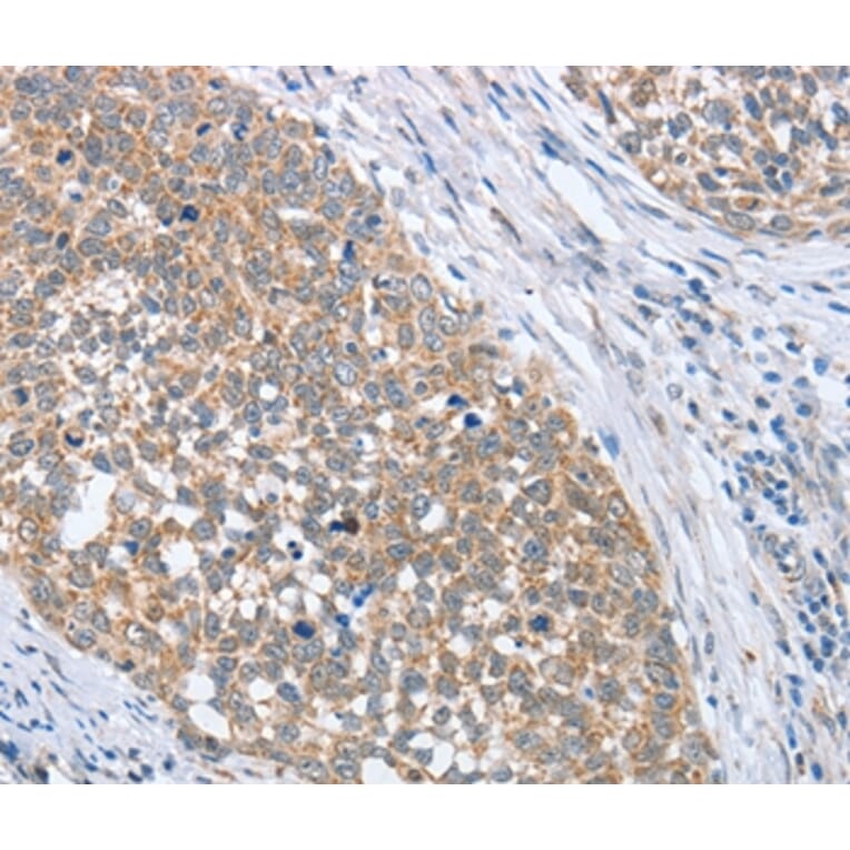 Immunohistochemistry - PAPSS1 Antibody from Signalway Antibody (36177) - Antibodies.com
