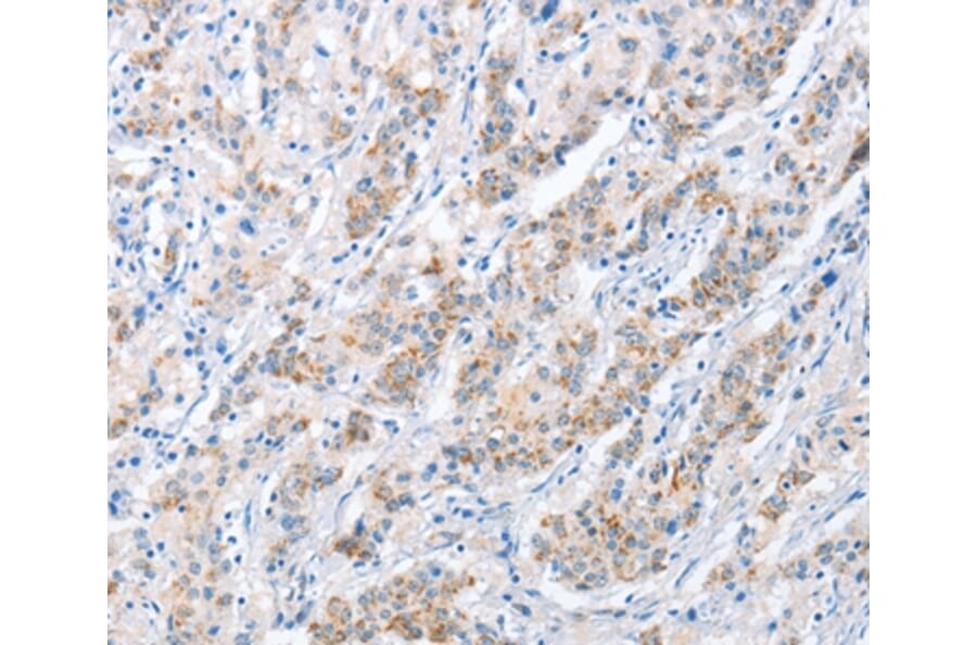 Immunohistochemistry - PAPSS1 Antibody from Signalway Antibody (36177) - Antibodies.com