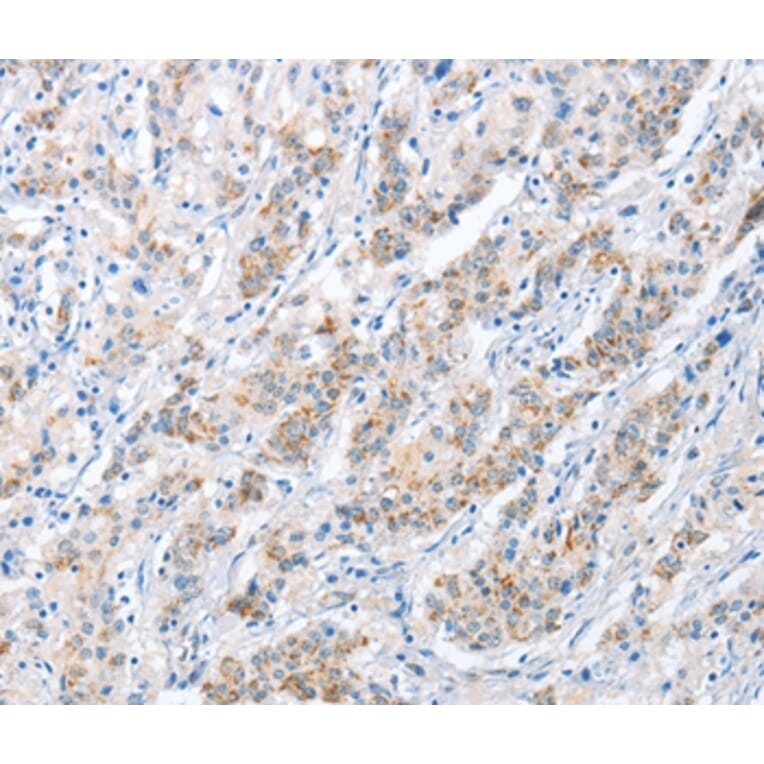 Immunohistochemistry - PAPSS1 Antibody from Signalway Antibody (36177) - Antibodies.com
