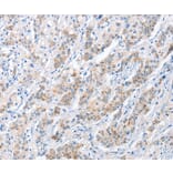 Immunohistochemistry - PAPSS1 Antibody from Signalway Antibody (36177) - Antibodies.com
