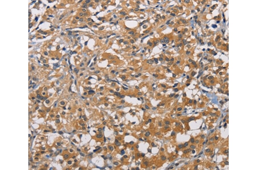 Immunohistochemistry - PIKFYV Antibody from Signalway Antibody (36194) - Antibodies.com