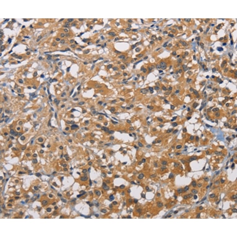 Immunohistochemistry - PIKFYV Antibody from Signalway Antibody (36194) - Antibodies.com