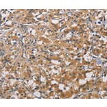 Immunohistochemistry - PIKFYV Antibody from Signalway Antibody (36194) - Antibodies.com