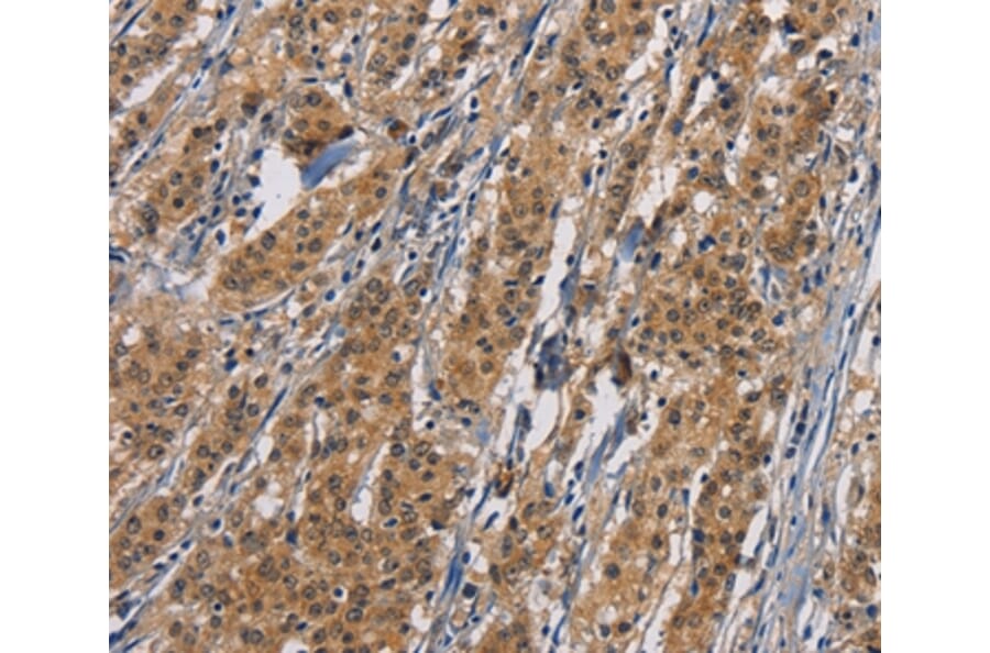 Immunohistochemistry - PIKFYV Antibody from Signalway Antibody (36194) - Antibodies.com