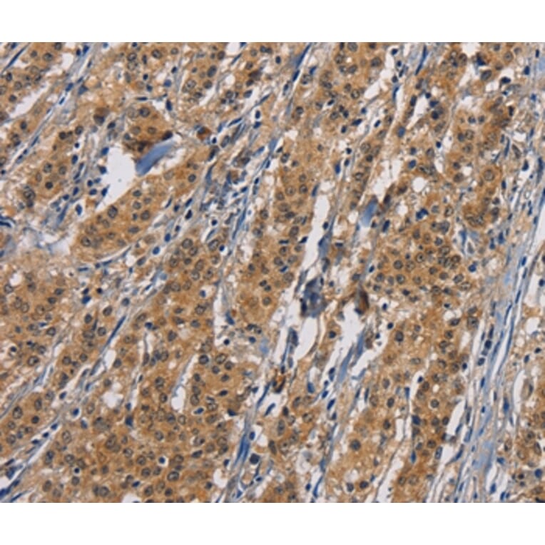 Immunohistochemistry - PIKFYV Antibody from Signalway Antibody (36194) - Antibodies.com